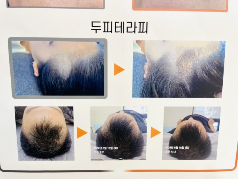 에스에스비 이미지