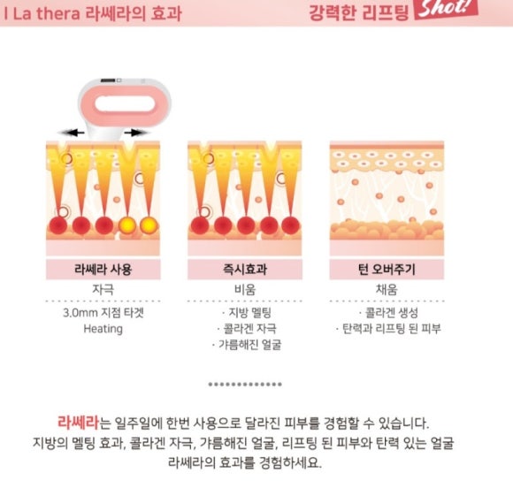 쎄라 이미지