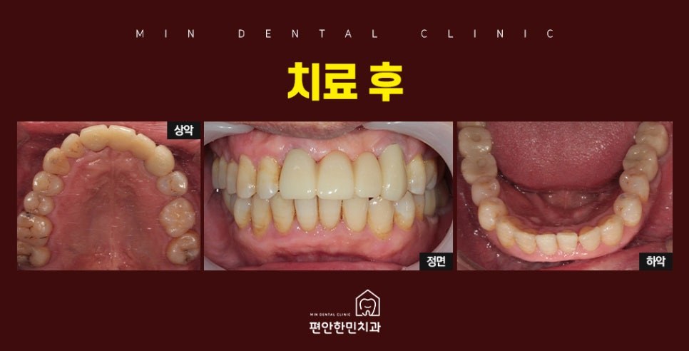 편안한민치과 이미지