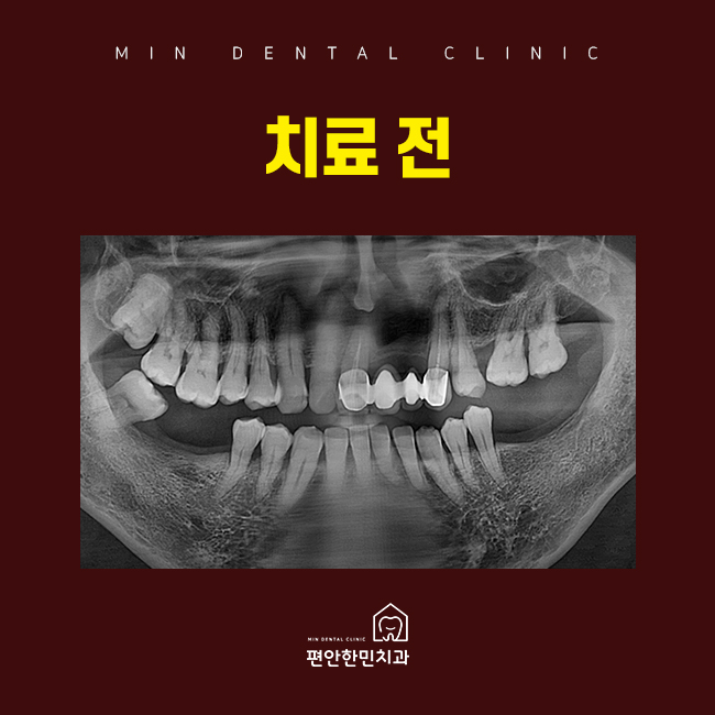 편안한민치과 이미지