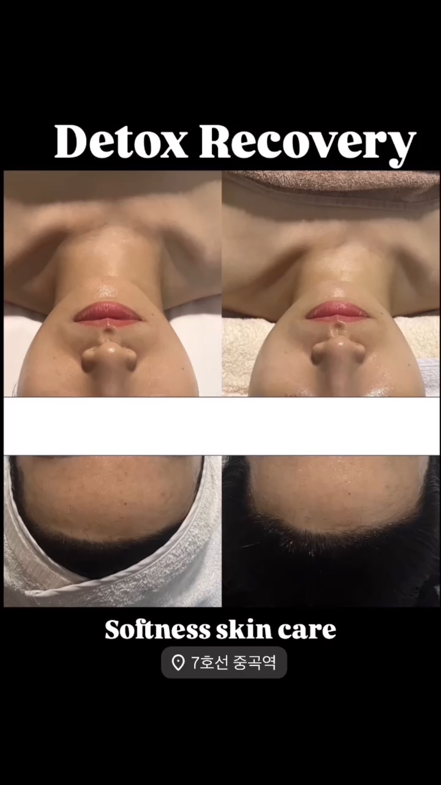 소프니스 이미지