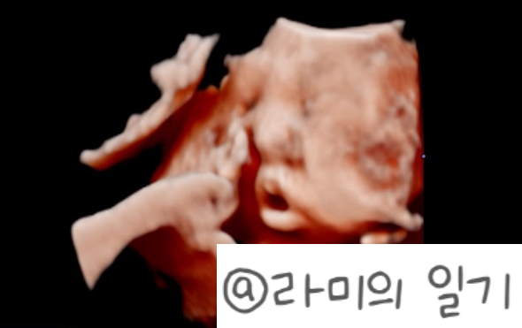 샬로미 이미지