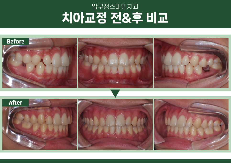 이.스마일치과교정과치과의원 이미지
