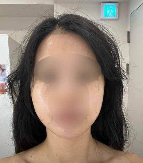 일라에스테틱 이미지
