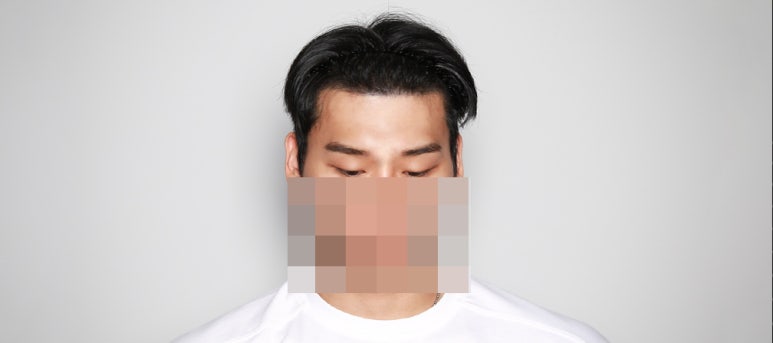 진헤어라인 이미지