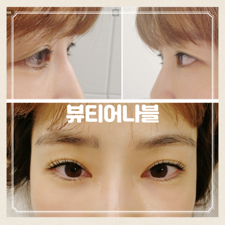 뷰티어나블 이미지