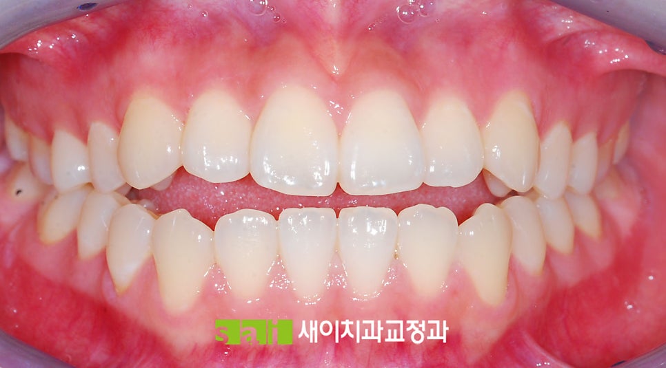새이치과교정과치과의원 이미지