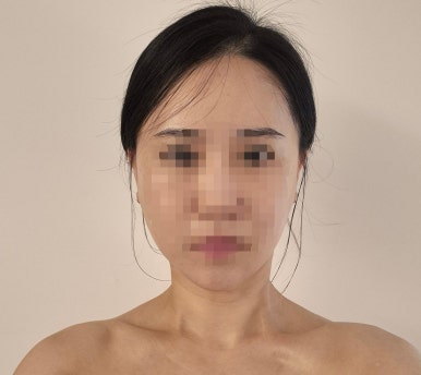 해피바디앤스킨 이미지