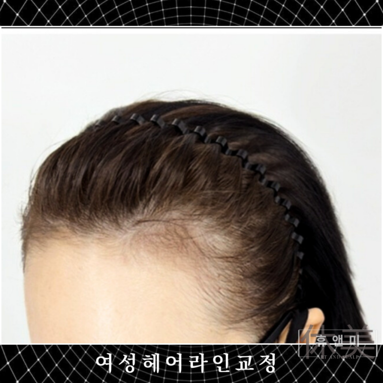 휴&미헤어 이미지