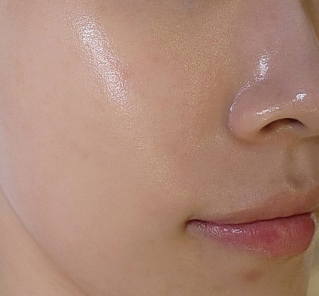 루온 에스테틱 이미지
