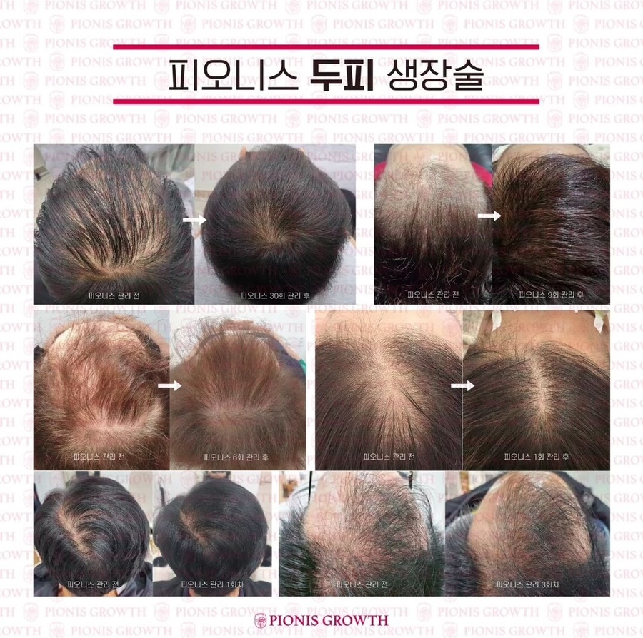피오케이 이미지