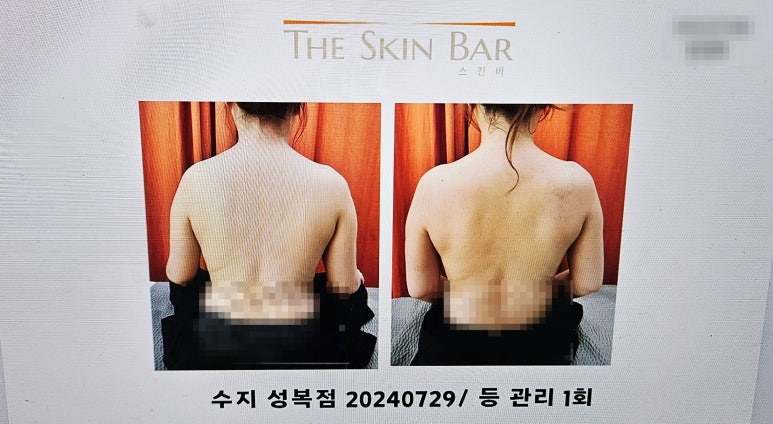 스킨바 수지성복점 이미지