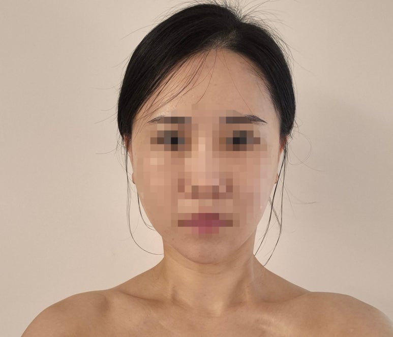 해피바디앤스킨 이미지