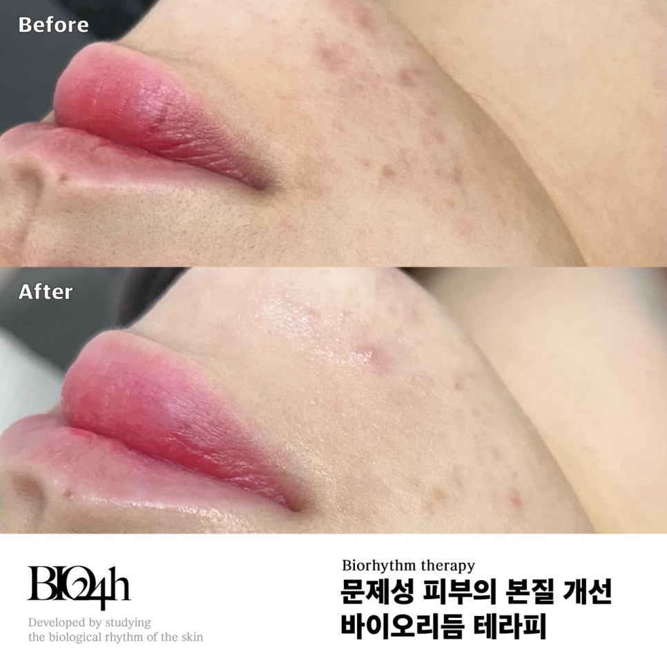 살롱드문 이미지