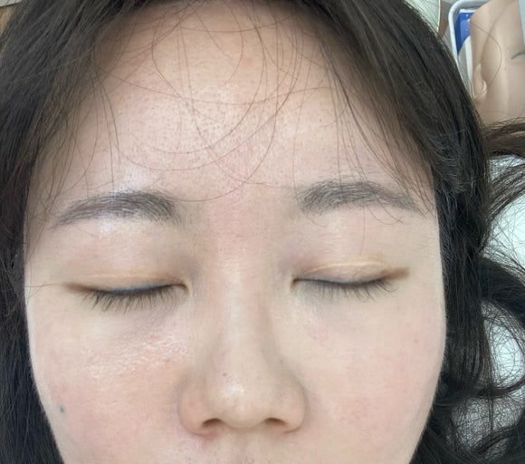 로로스킨케어 이미지