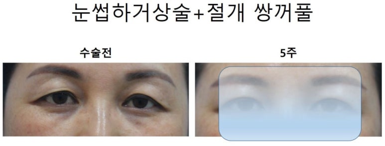 엄지연합의원 이미지
