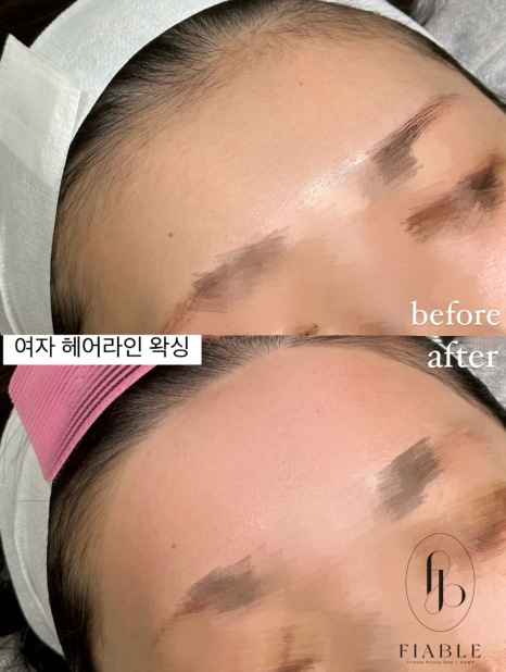 피아블레왁싱 이미지