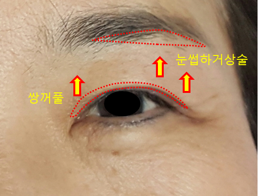 엄지연합의원 이미지
