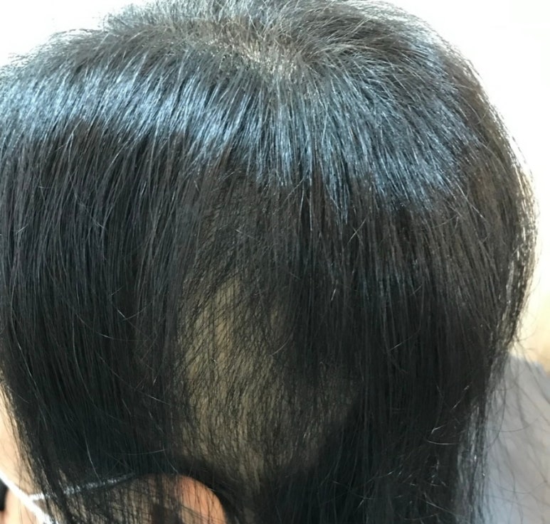 더모어 이미지