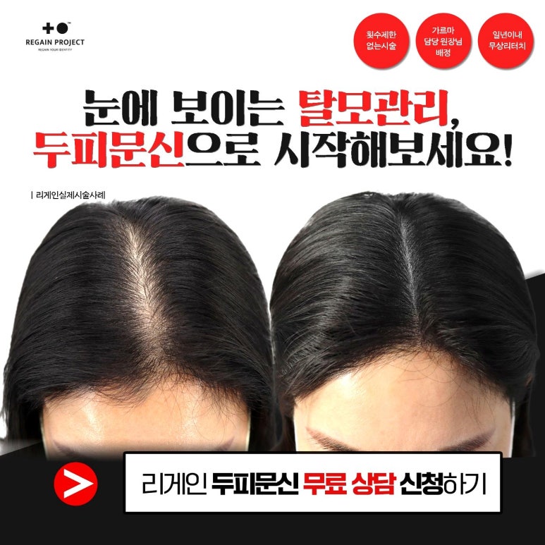 리게인프로젝트 이미지