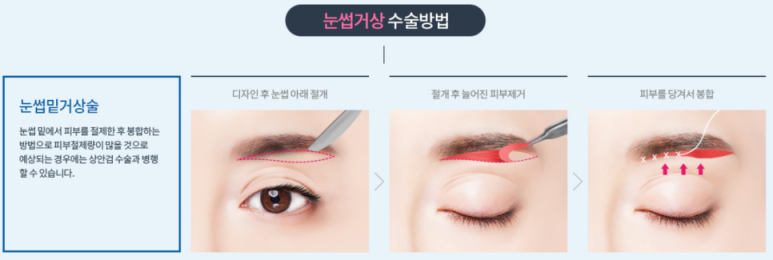 엄지연합의원 이미지