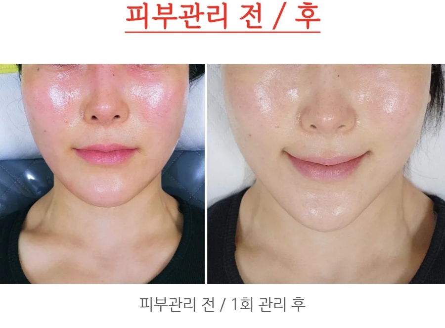 뉴진공방&솔에스테틱 경기용인점 이미지