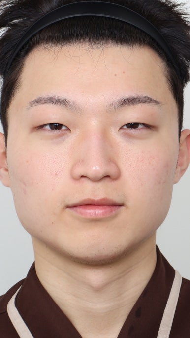 뉴진성형외과 이미지