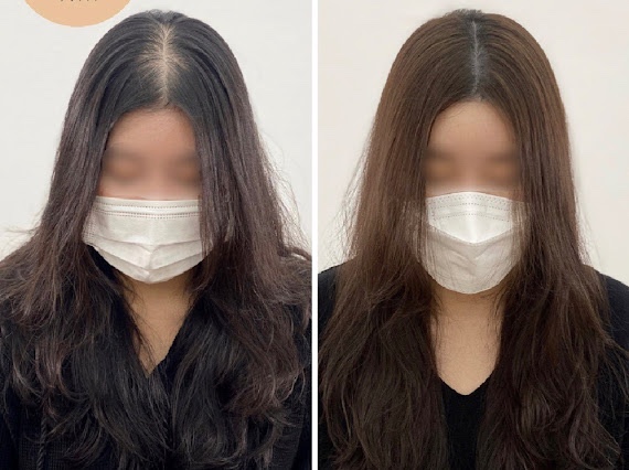 마음에점을찍다두피SMP 이미지