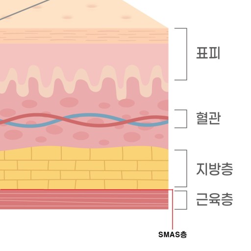 에스테라파 이미지