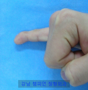 강남챔피언정형외과의원 이미지