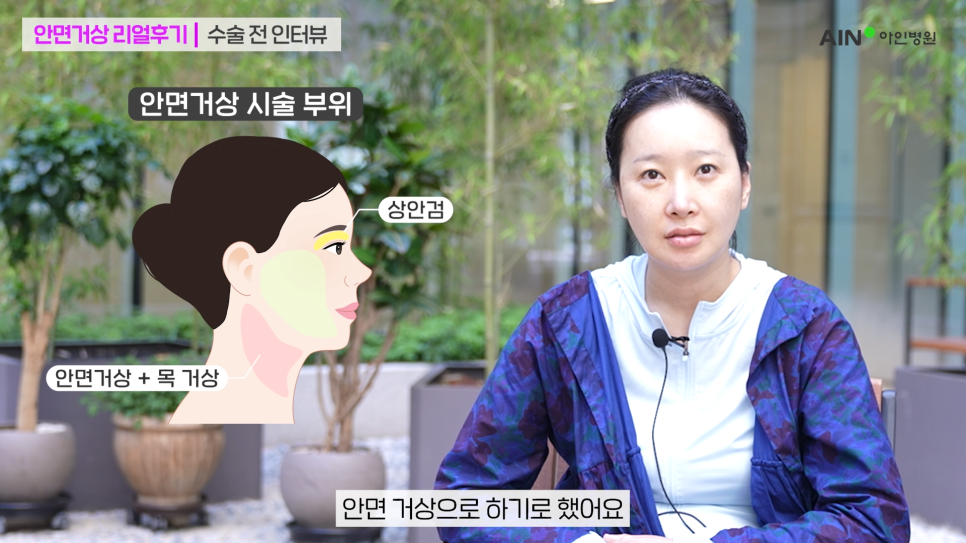 아인성형외과 이미지