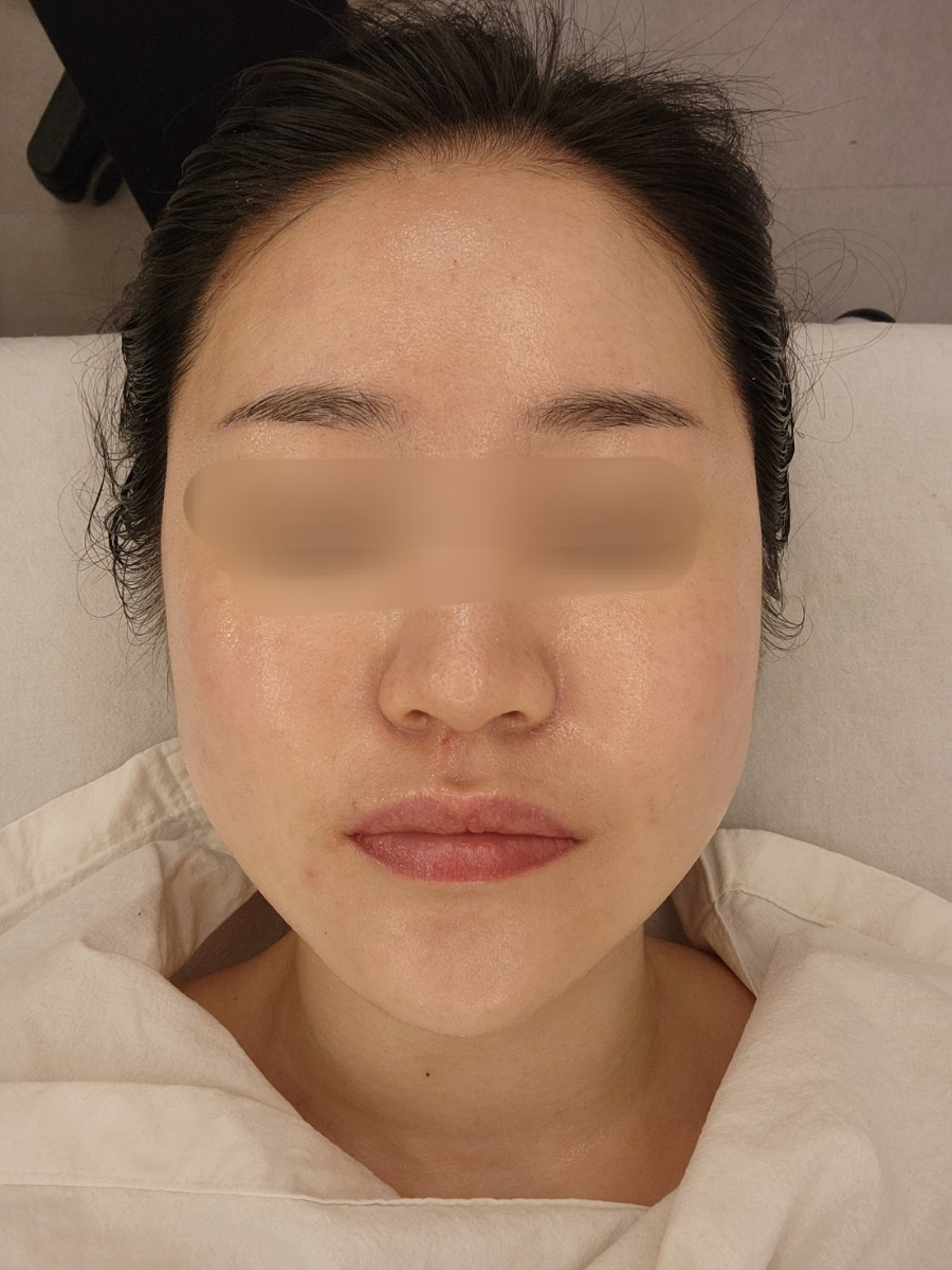 플러팅테라피 이미지