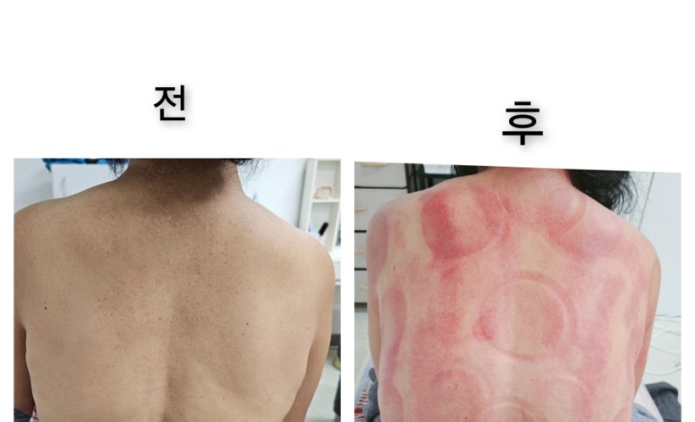 오늘은밝은피부 이미지