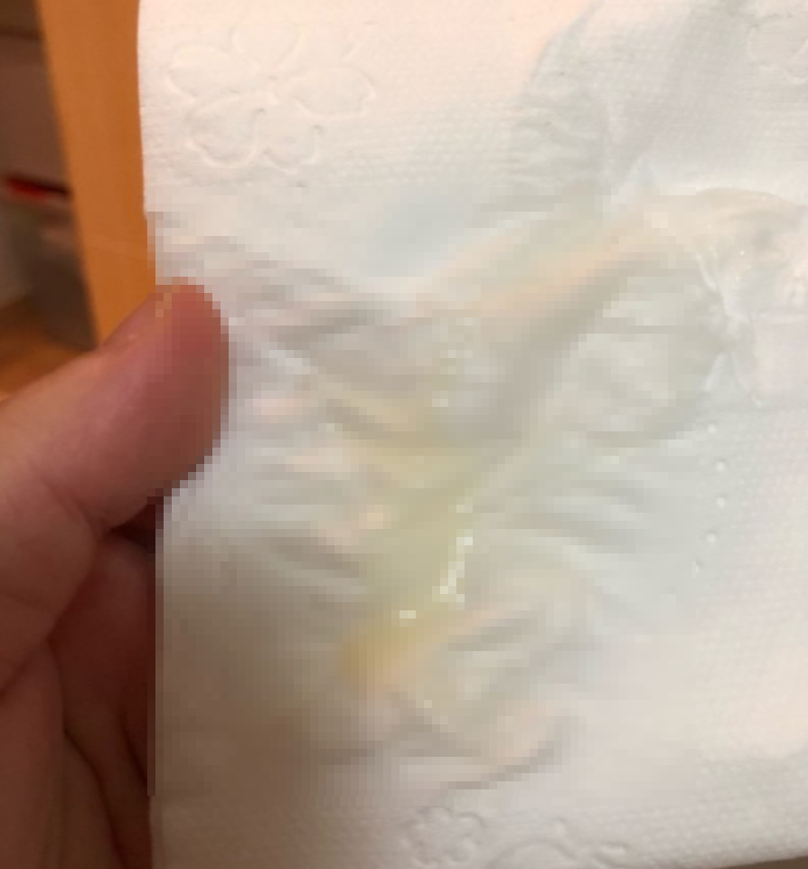 연산부인과 이미지