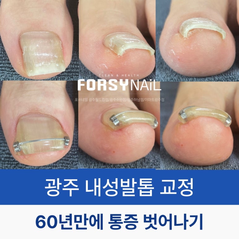 내성광고 이미지