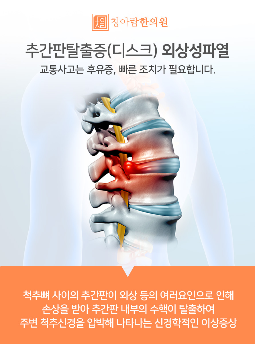 양촌한의원 이미지