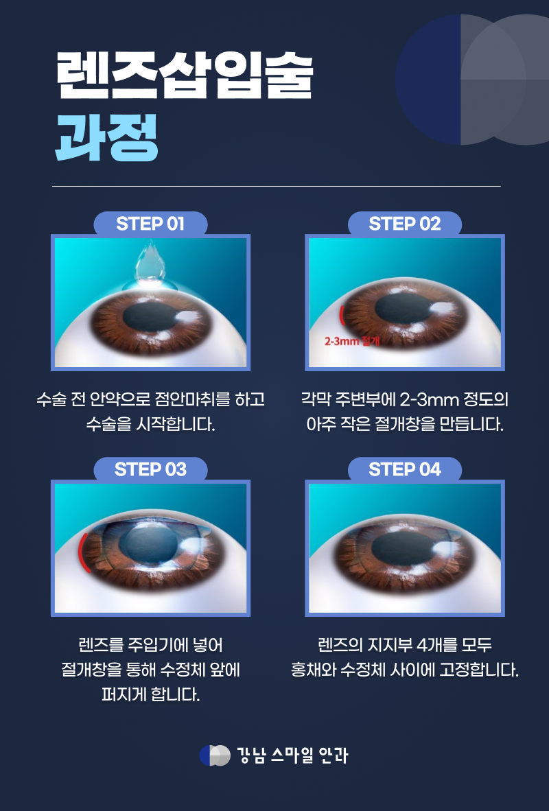 렌즈공간 이미지