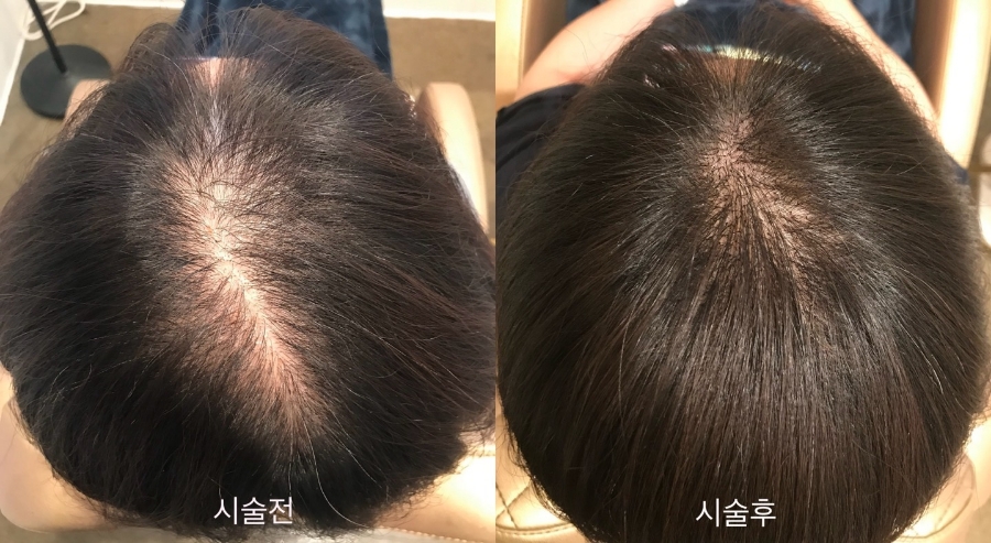 더모어 이미지