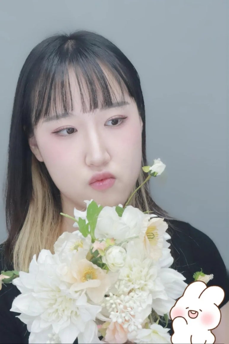 아이그램성형외과 이미지