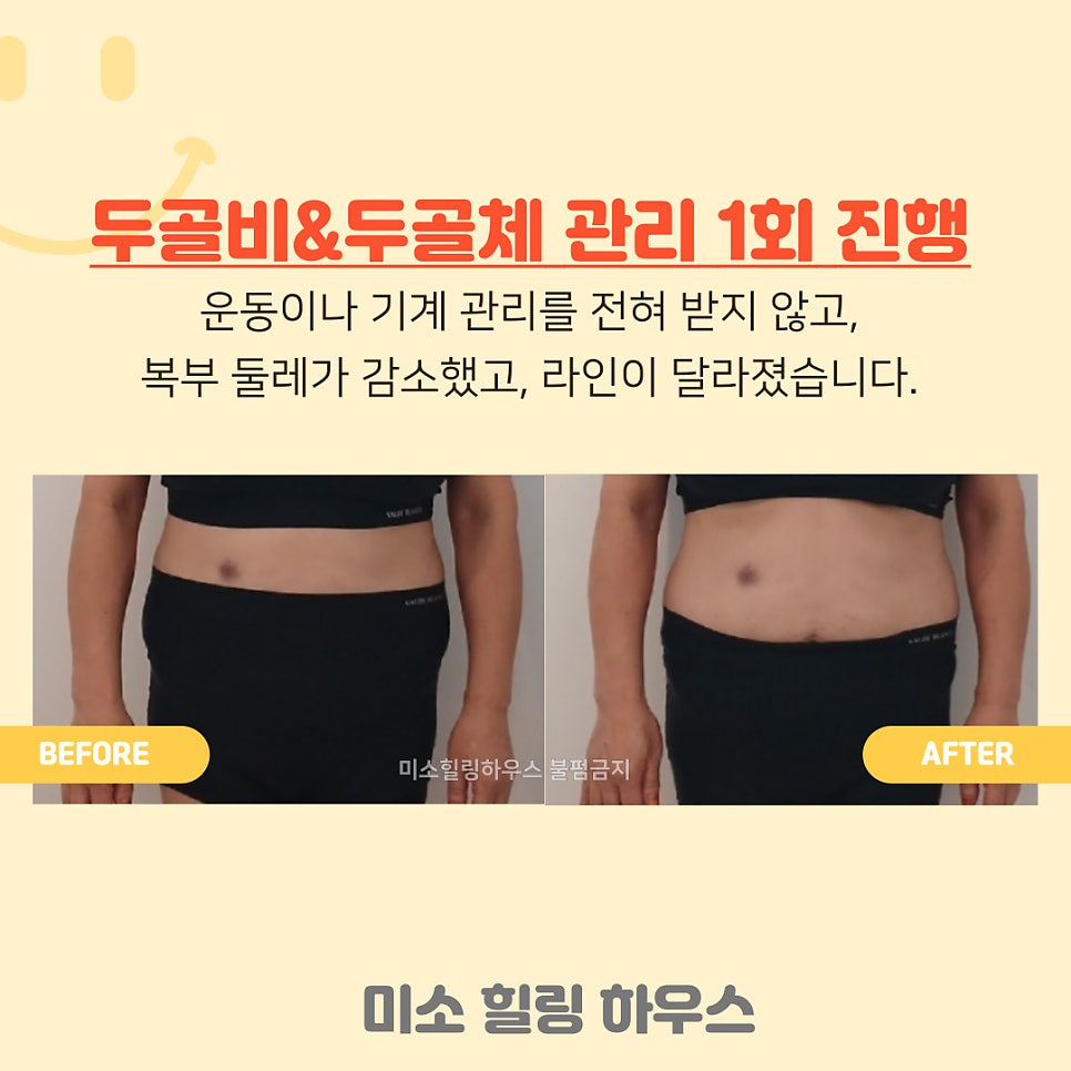 알로벳 이미지