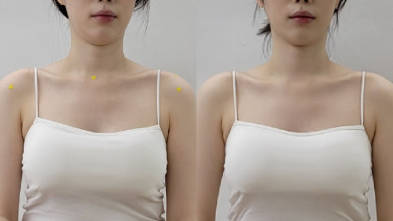 투턱 이미지