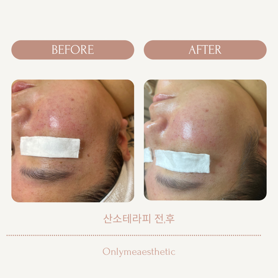 팡팡테라피 이미지