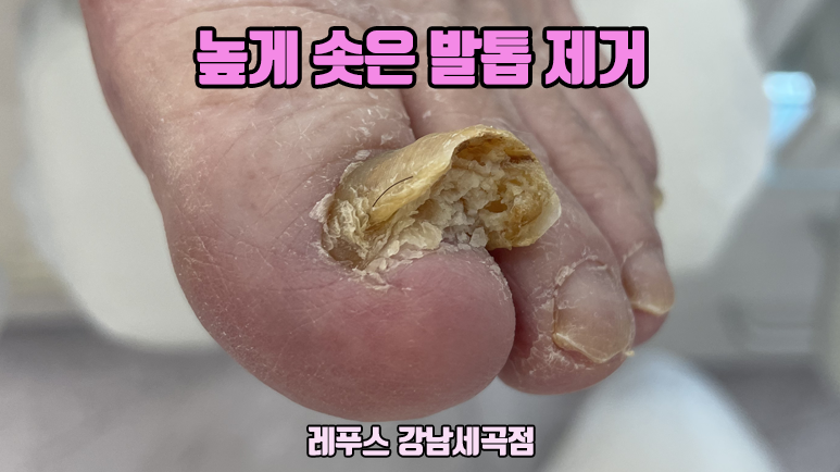 레푸스강남세곡점 이미지