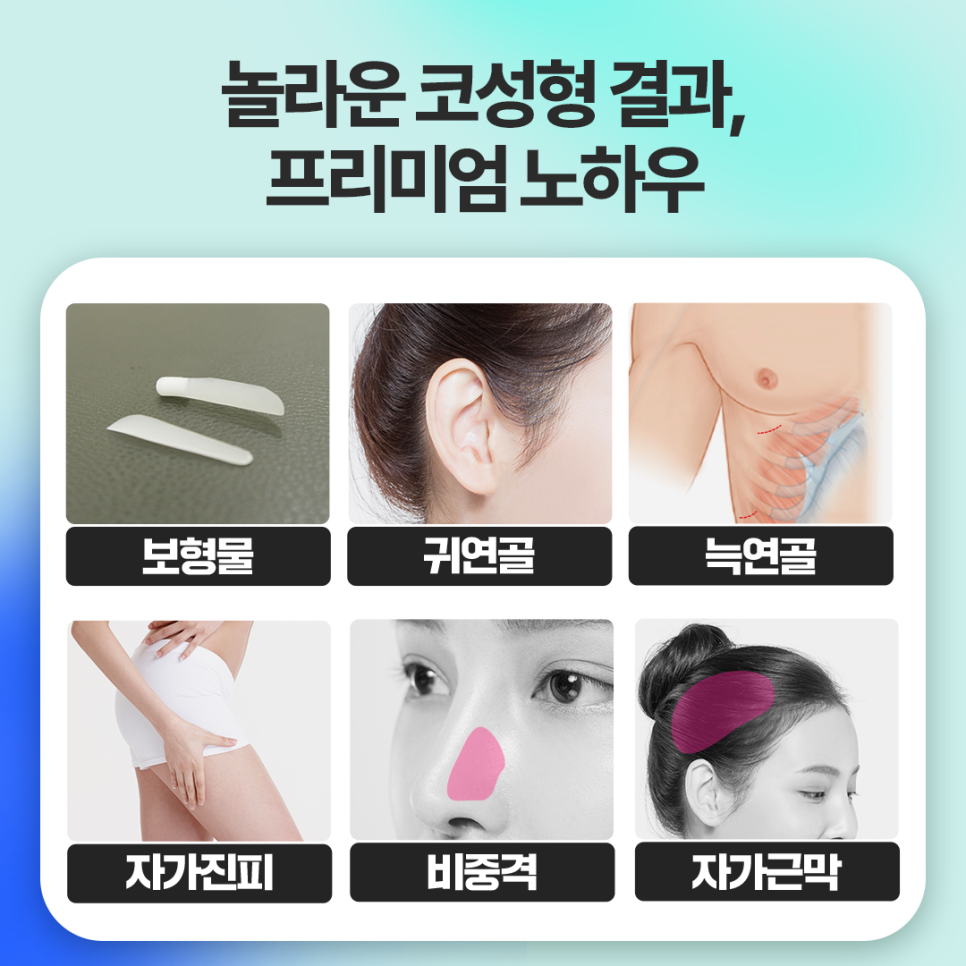 조각성형외과의원 이미지