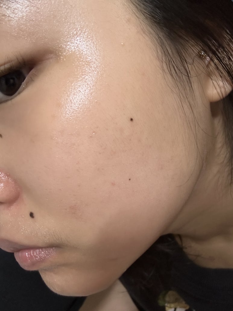 화이트 미 스킨케어 이미지