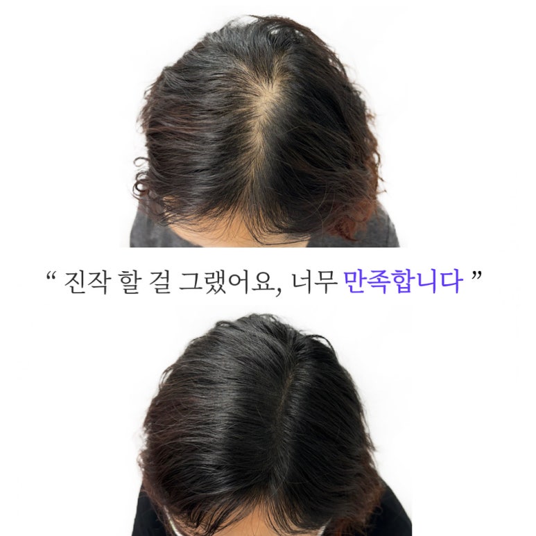 잉크본 이미지