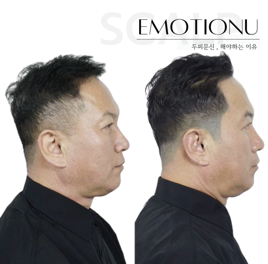 이모션유 이미지