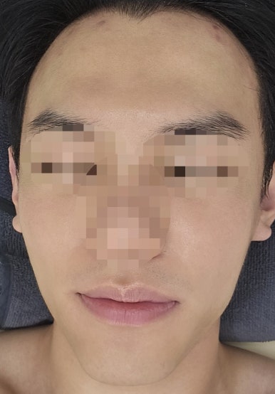 가림피부관리 이미지