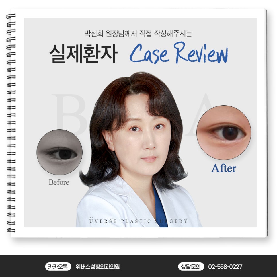 박선희속눈썹 이미지