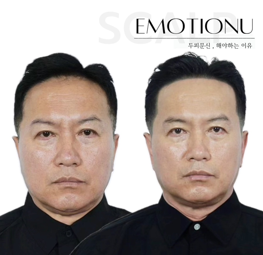 이모션유 이미지